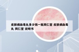皮膚病血毒丸多少錢一瓶同仁堂 皮膚病血毒丸 同仁堂 說明書