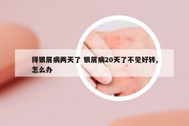 得銀屑病兩天了 銀屑病20天了不見好轉(zhuǎn),怎么辦