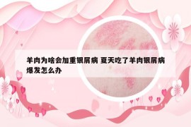 羊肉為啥會加重銀屑病 夏天吃了羊肉銀屑病爆發(fā)怎么辦