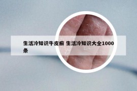 生活冷知識牛皮癬 生活冷知識大全1000條