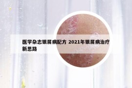 醫(yī)學(xué)雜志銀屑病配方 2021年銀屑病治療新思路