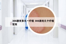 308激光多久一療程 308激光幾個療程見效