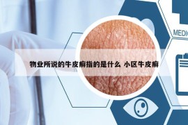 物業(yè)所說的牛皮癬指的是什么 小區(qū)牛皮癬