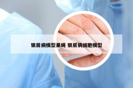 銀屑病模型果蠅 銀屑病細胞模型