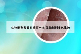 生物制劑多長(zhǎng)時(shí)間打一次 生物制劑多久生效