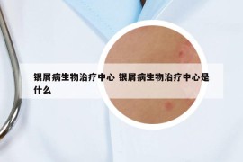銀屑病生物治療中心 銀屑病生物治療中心是什么