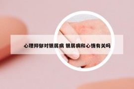心理抑郁對銀屑病 銀屑病和心情有關嗎