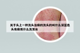 關(guān)于頭上一種洗頭治癬的洗頭的叫什么深藍(lán)色 頭有癬用什么洗發(fā)水