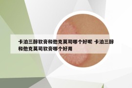 卡泊三醇軟膏和他克莫司哪個好呢 卡泊三醇和他克莫司軟膏哪個好用