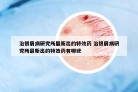 治銀屑病研究所最新出的特效藥 治銀屑病研究所最新出的特效藥有哪些