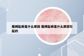 胳膊起癬是什么原因 胳膊起癬是什么原因引起的