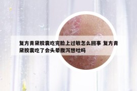 復(fù)方青黛膠囊吃完臉上過敏怎么回事 復(fù)方青黛膠囊吃了會頭暈腹瀉想吐嗎