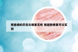 銀翹病的藥膏從哪里買呢 銀翹散哪里可以買到