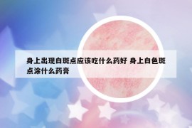 身上出現(xiàn)白斑點應(yīng)該吃什么藥好 身上白色斑點涂什么藥膏