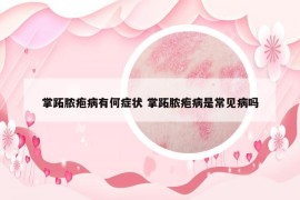 掌跖膿皰病有何癥狀 掌跖膿皰病是常見(jiàn)病嗎
