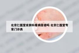 北京仁醫(yī)堂皮膚科看病靠譜嗎 北京仁醫(yī)堂專家門診表