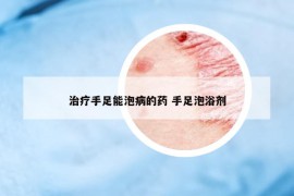 治療手足能泡病的藥 手足泡浴劑