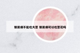 銀屑病不能吃大蔥 銀屑病可以吃蔥花嗎