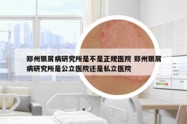 鄭州銀屑病研究所是不是正規(guī)醫(yī)院 鄭州銀屑病研究所是公立醫(yī)院還是私立醫(yī)院