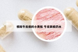 根除牛皮癬的小黃瓶 牛皮膚癬藥水