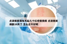 點滴銀屑病每天起幾個紅疙瘩很癢 點滴銀屑病都20天了 怎么還不好呢