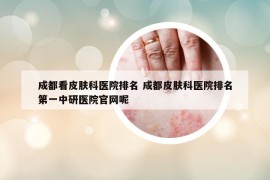 成都看皮膚科醫(yī)院排名 成都皮膚科醫(yī)院排名第一中研醫(yī)院官網(wǎng)呢