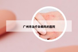 廣州市治療白癜風(fēng)的醫(yī)院