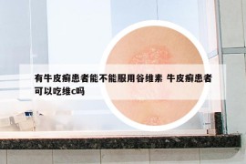 有牛皮癬患者能不能服用谷維素 牛皮癬患者可以吃維c嗎