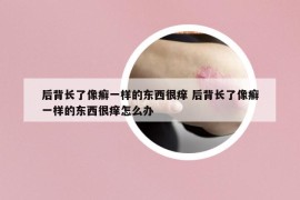 后背長了像癬一樣的東西很癢 后背長了像癬一樣的東西很癢怎么辦