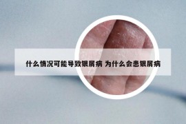 什么情況可能導(dǎo)致銀屑病 為什么會患銀屑病