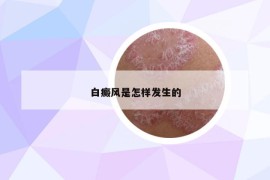 白癜風是怎樣發(fā)生的