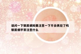 請問一下銀屑病如果注意一下不會再犯了嗎 銀屑病平常注意什么