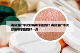 婁底治療牛皮膚癬哪家醫(yī)院好 婁底治療牛皮膚癬哪家醫(yī)院好一點