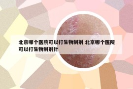 北京哪個醫(yī)院可以打生物制劑 北京哪個醫(yī)院可以打生物制劑針