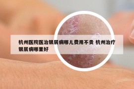 杭州醫(yī)院醫(yī)治銀屑病哪兒費用不貴 杭州治療銀屑病哪里好