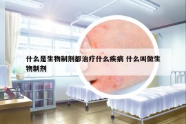 什么是生物制劑都治療什么疾病 什么叫做生物制劑
