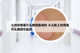 小孩白斑是什么原因造成的 小兒臉上白斑是什么原因引起的