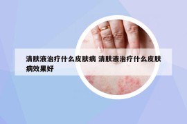 清膚液治療什么皮膚病 清膚液治療什么皮膚病效果好
