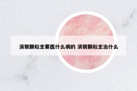 消銀顆粒主要醫(yī)什么病的 消銀顆粒主治什么