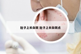 肚子上長白斑 肚子上長白斑點