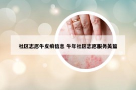 社區(qū)志愿牛皮癬信息 牛年社區(qū)志愿服務(wù)美篇