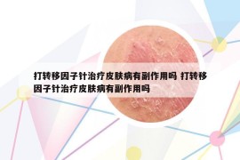 打轉(zhuǎn)移因子針治療皮膚病有副作用嗎 打轉(zhuǎn)移因子針治療皮膚病有副作用嗎