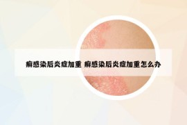 癬感染后炎癥加重 癬感染后炎癥加重怎么辦
