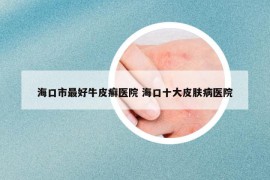 ?？谑凶詈门Ｆぐ_醫(yī)院 海口十大皮膚病醫(yī)院