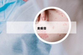 青癬膏