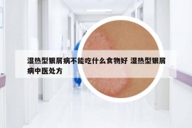 濕熱型銀屑病不能吃什么食物好 濕熱型銀屑病中醫(yī)處方