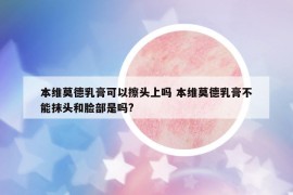 本維莫德乳膏可以擦頭上嗎 本維莫德乳膏不能抹頭和臉部是嗎?