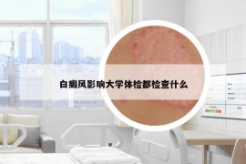 白癜風(fēng)影響大學(xué)體檢都檢查什么