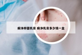 癬凈抑菌乳膏 癬凈乳膏多少錢一盒