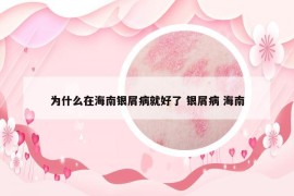 為什么在海南銀屑病就好了 銀屑病 海南